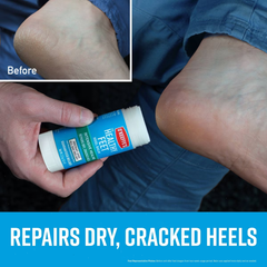 O'Keeffe's Healthy Feet Intensive Healing Balm - 2oz