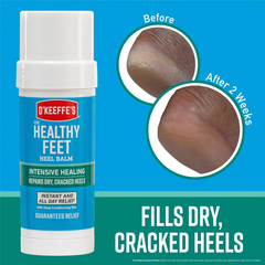 O'Keeffe's Healthy Feet Intensive Healing Balm - 2oz